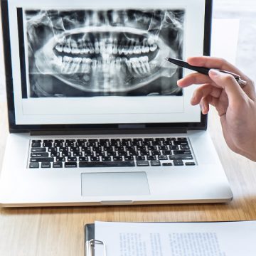 Traditional or Digital X-Ray: Which Is Best for Dental Use?